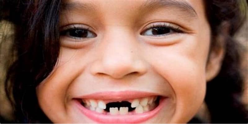 Giải mã chi tiết giấc mơ thấy rụng răng
